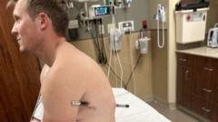 man impaled by a hiking pole treks 10 miles down mountain